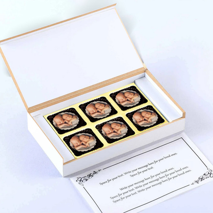 Floral framed photo printed chocolates baby announcement